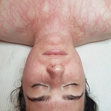 Observ Skin Analysis – Body Beautiful Retreat – Brisbane