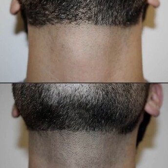 Observ Skin Analysis – Body Beautiful Retreat – Brisbane