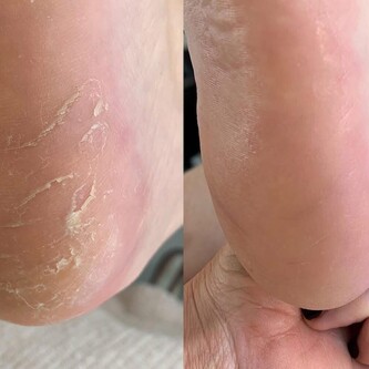 Observ Skin Analysis – Body Beautiful Retreat – Brisbane