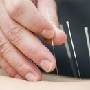 Dry needling - An excellent way to further release tight and sore muscles